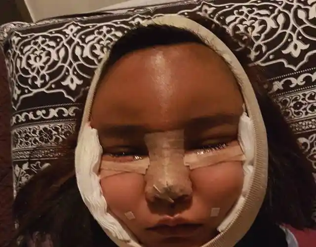 泰国网红4姐妹整容后绑绷带上街吓坏网友