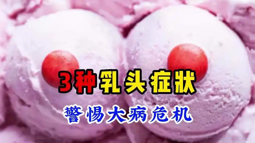 3种乳头症状警惕大病危机