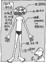 > 查看版本 马凡氏综合征患者最显著的特征就是骨骼系统的变化.