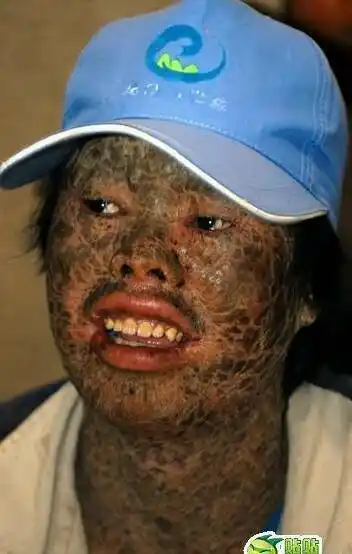 人要是太帅了烦恼很多,女孩天天追人烦死了!怎么办啊