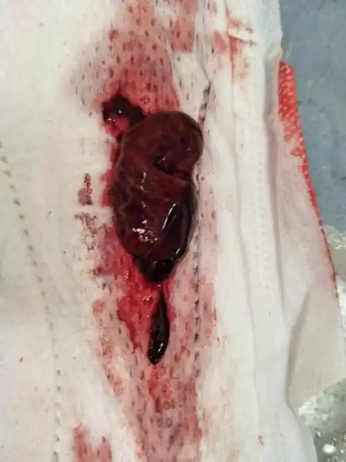 小天天伦  浏览   次   举报 我有更好的答案