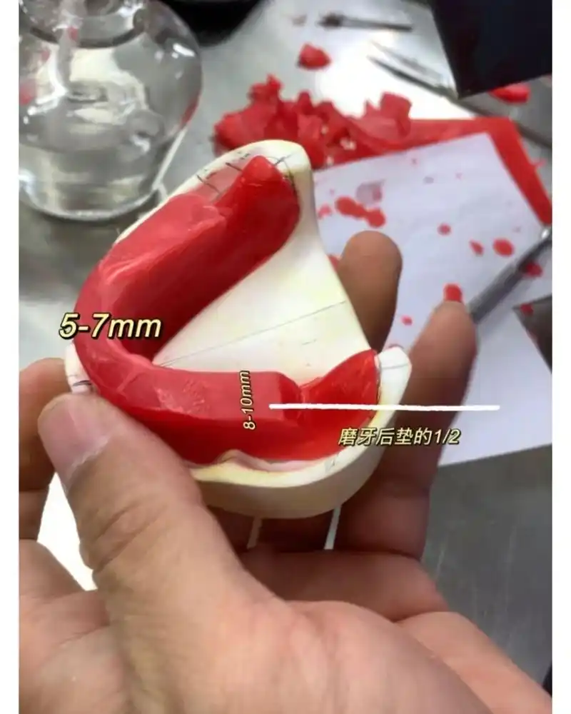 排牙第三步:铺蜡堤 铺蜡堤细节图来啦#口腔