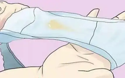 东营博爱医院妇科医生介绍,一般来说,正常白带呈白色糊状或蛋清样