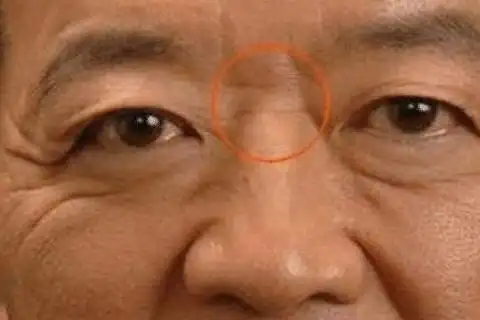 男女山根有横纹的面相分析山根有一条横纹,人生将遭逢一次重大的感情