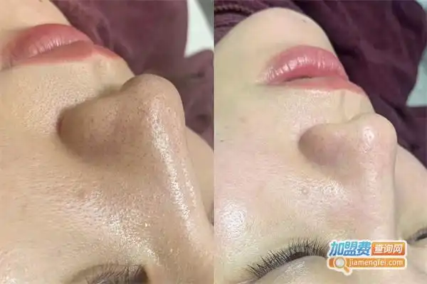 八叶莲华毛囊清洁加盟费开200㎡八叶莲华毛囊清洁加盟店大概要5356