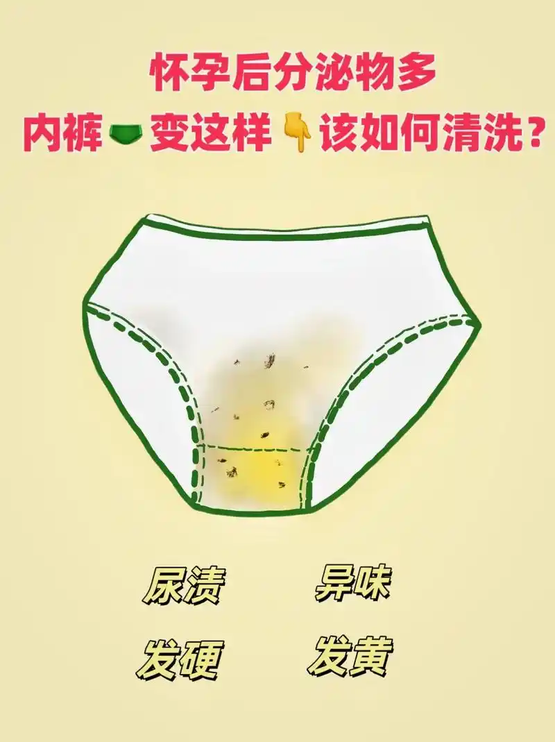 怀孕了洗内内一定不能马虎!#孕期 分泌物变多,内裤湿答答还有 - 抖音