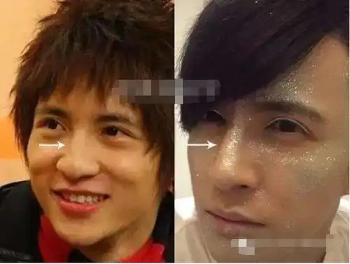 雨桐的闺蜜就在微博上到处说薛之谦整容的事情,说他哪一年割了双眼皮