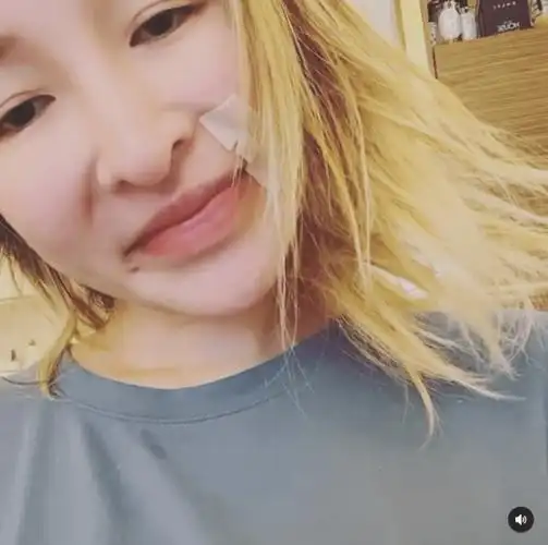 萧亚轩素颜出镜嘴角贴胶布,瘪嘴委屈情绪不佳,喊话给点时间会好_状态