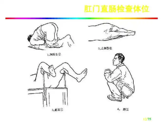 临床医学 钦州市第一人民医院临床诊疗指南培训ppt 肛门直肠检查体位