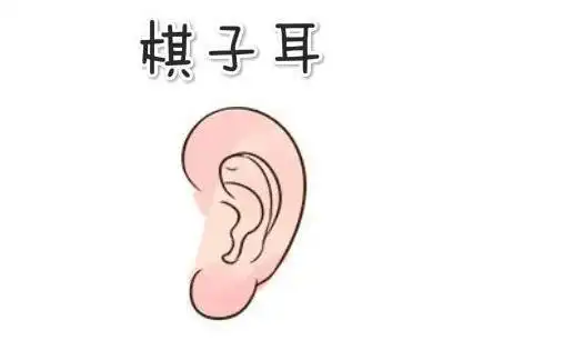 棋子耳在相学中,所谓的棋子耳,就是指,耳朵生得圆小而坚实也没有明显