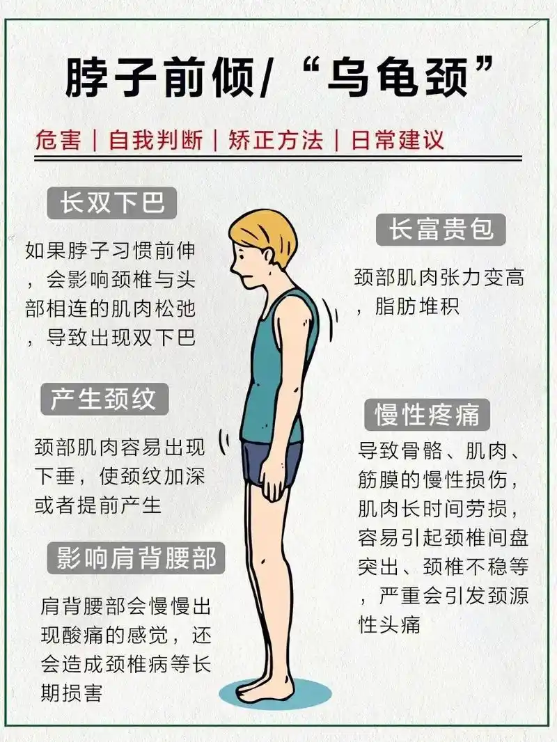 驼背,"乌龟颈"危害,以及纠正动作.脖子前倾会让你的美貌打折 - 抖音