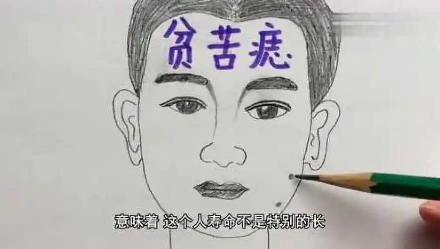 下巴长痣解读,解析几处不利,会破财的痣相_腾讯视频