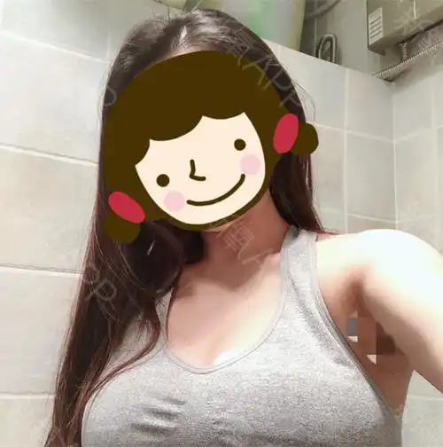 虽说现在胸上只用贴着纱布就行,直接套上衣服就可以出门.