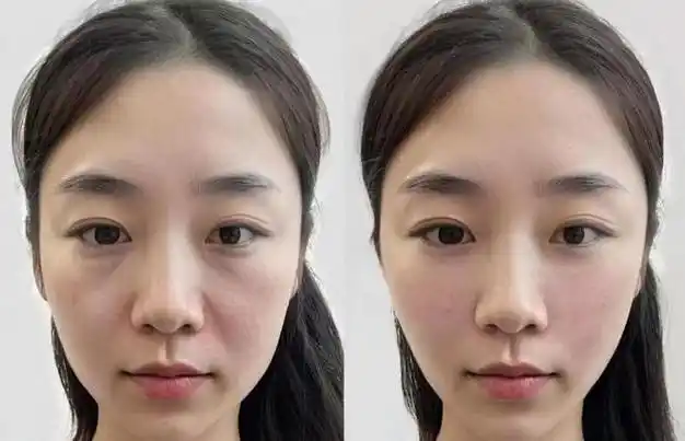 胭脂树籽精萃,能调节皮脂分泌,改善毛孔并减少油光.