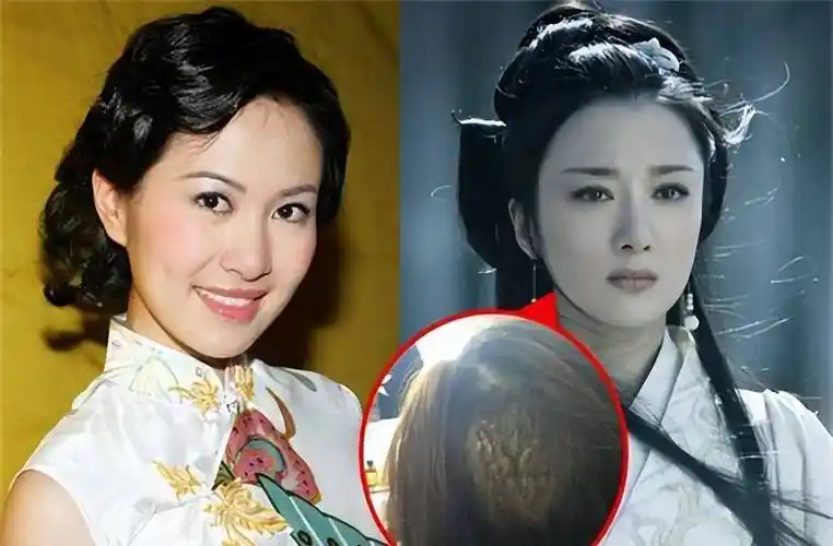 她曾被称为"第一古装美人":被狗咬到毁容,整容后却只能演反派_李依晓