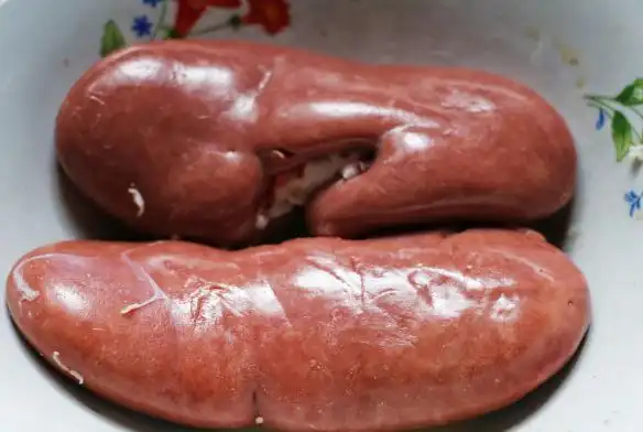 43岁男子尿酸高达830肾脏衰竭医生摇头祸首是一种家常菜