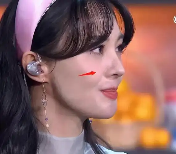 郑爽整容后照片郑爽淡妆暴露整容后遗症