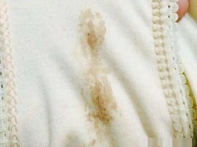 怀孕后有褐色分泌物是怎么回事?