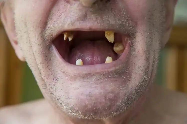 图片来源:站酷海洛 我们一向将牙齿的掉落视为自然规律,而不是疾病