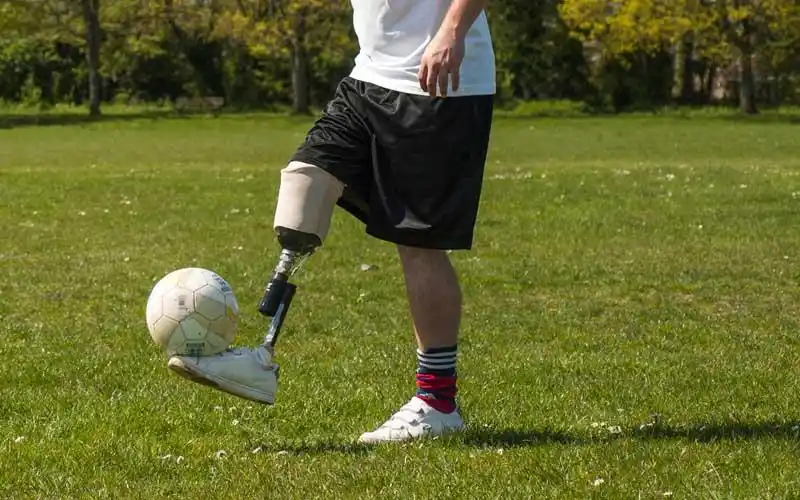 眉山进口假肢哪里有