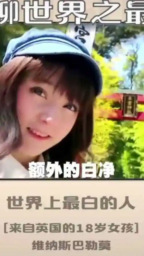 世界上最白的人,维纳斯·巴勒莫有着芭比娃娃般白皙的面孔,一夜之间爆