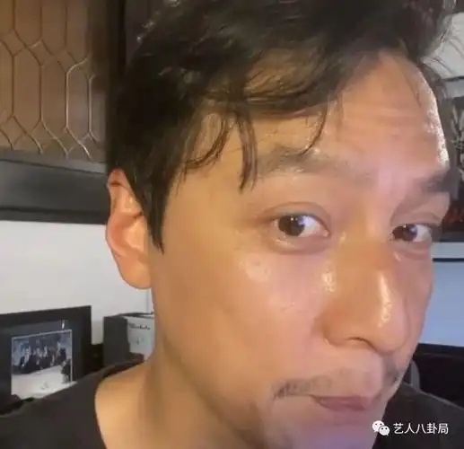 头发稀疏,留胡子略显憔悴!