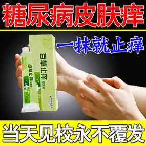 糖尿病皮肤痒神器老年人皮肤瘙痒全身干燥脱皮肾透析痒特效止痒膏