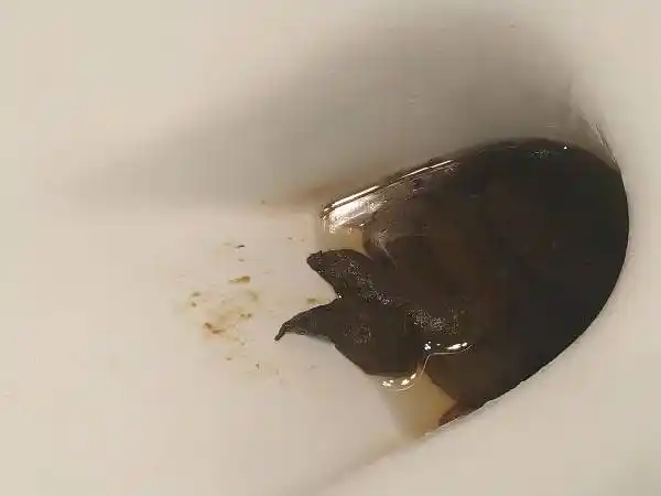 想问一下这种算黑便吗?