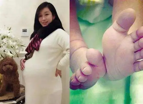 秦海璐谈产娃之痛,患上抑郁症,儿子变巨婴让她害怕