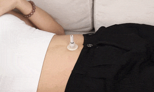 肚子大,头发油,口臭是有湿气?真人实测这个方法._艾灸_皮肤_肚脐眼