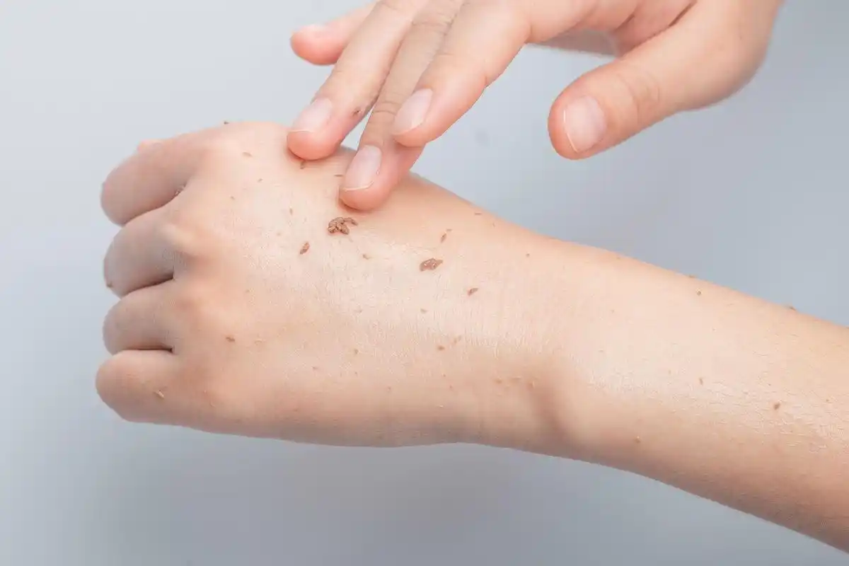 miorio米澳拉黄糖去角质凝胶啫喱