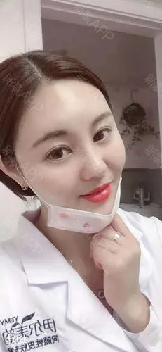 自体脂肪填充全脸