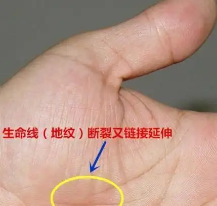 从手相看疾病这个地方有纹路的人身体不会太好