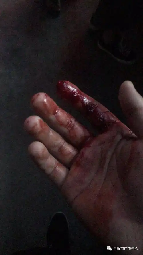 一双带血的手