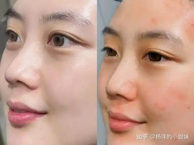 祛黄美白真的好用?本人亲测短期内可以有效祛黄美白! - 知乎