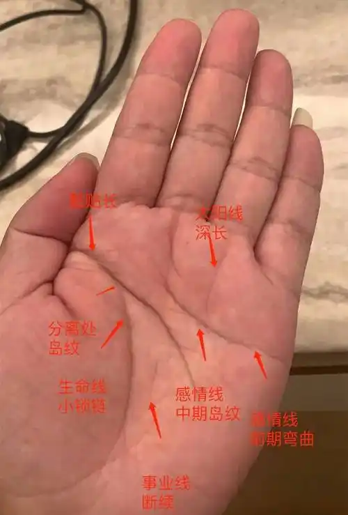 左手生命线30岁之前见小锁链纹,成家结婚的初期,会经历一些阻碍,从