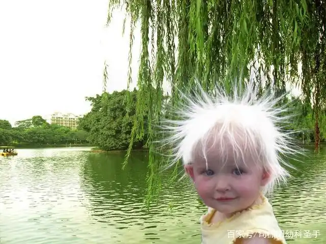 孩子为什么有白头发?怎么办?