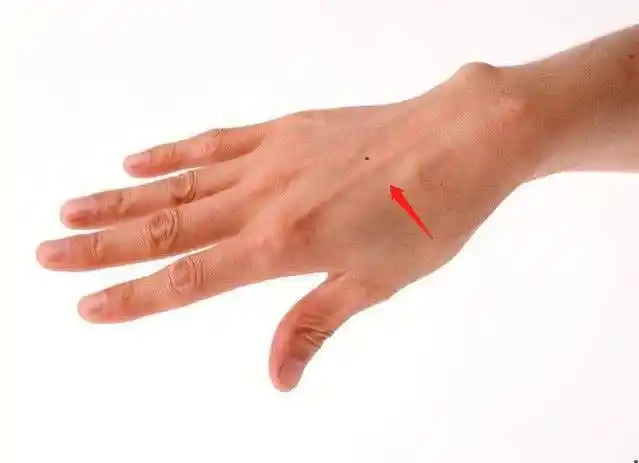 右手手背上有痣的男人运势如何?_网易订阅