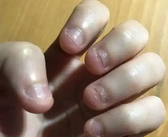 优家说 | 孩子爱咬指甲是缺维生素吗?_图片