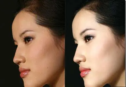 打美白针前后对比图