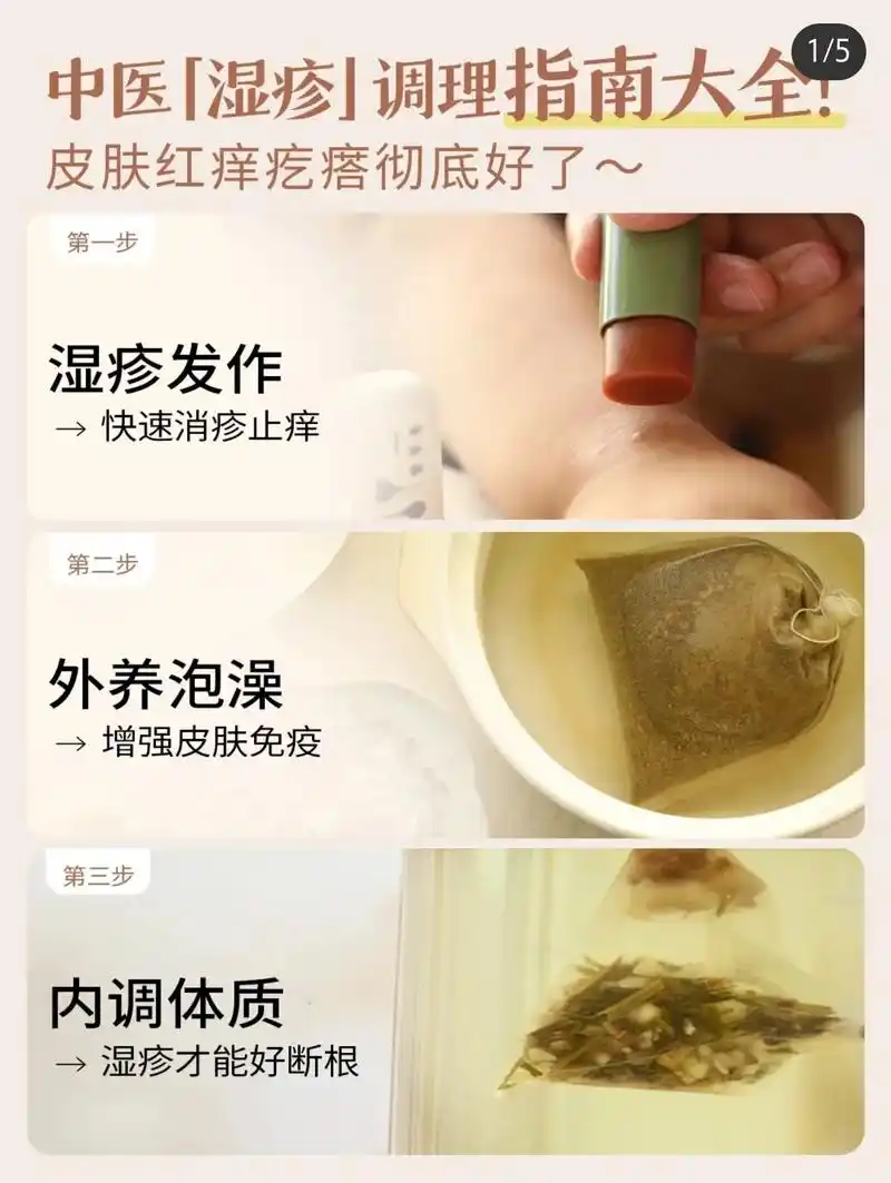 中医【湿疹﹣调理指南大全◇皮肤红痒疙瘩好了 ★★★夏季皮肤问 - 抖