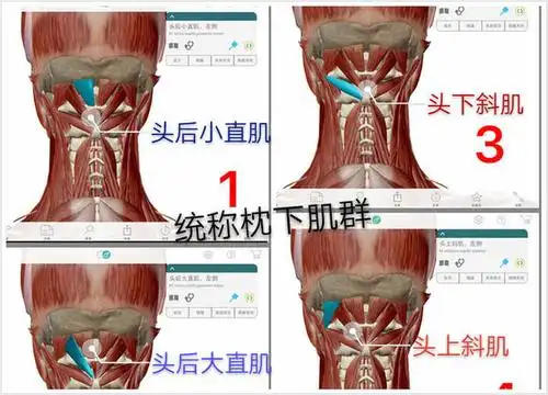 枕下肌群包括:头后小直肌,头后大直肌,头上斜肌,头下斜肌.
