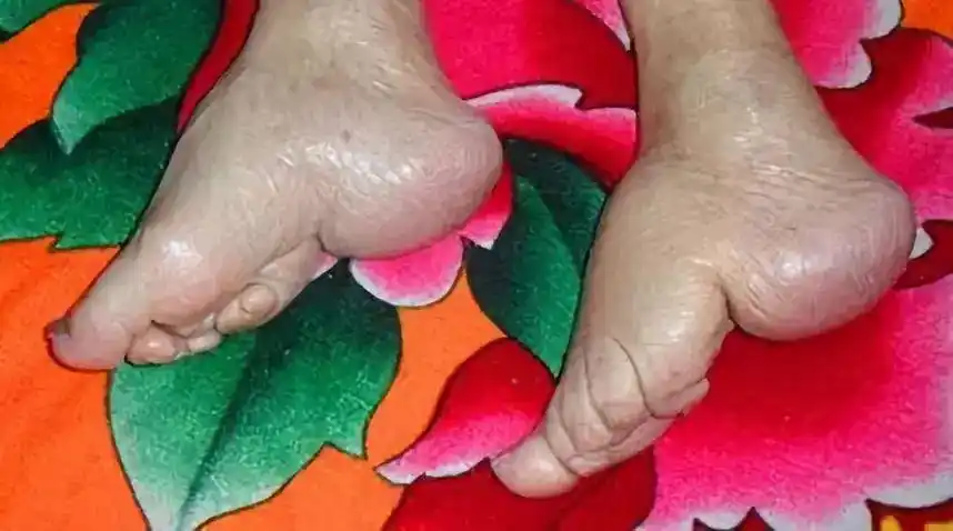 【文化分享】为什么古代的女孩子必须要裹脚?