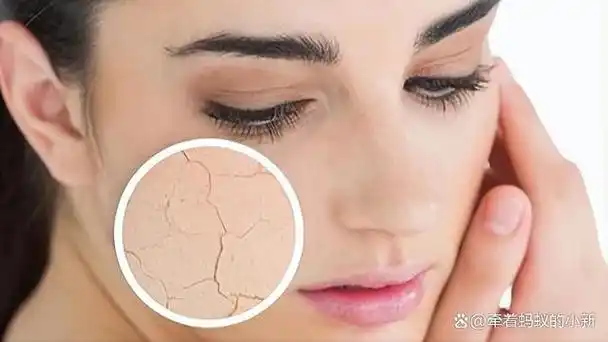 大量喝水真能达到给皮肤进行补水的功效吗?怎样有效给皮肤补水?