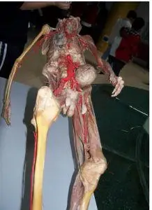 人体标本_互动百科