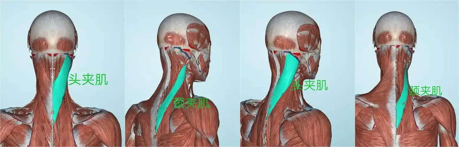 医生顺着头夹肌,颈夹肌牵拉力的方向,将紧张的肌纤维两端定点卡住