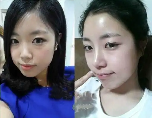 低鼻梁与高鼻梁的审美差距