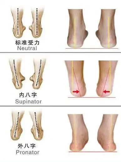 宝宝走路呈八字 宝妈该怎么办