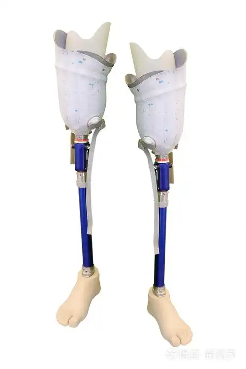 医学假腿照片-正版商用图片0uwbgt-摄图新视界