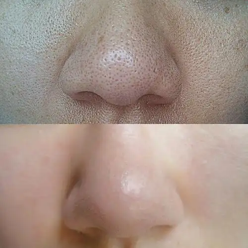 收缩毛孔精华液收毛孔粗大修复面部精华紧致男女收敛水补水保湿tmall